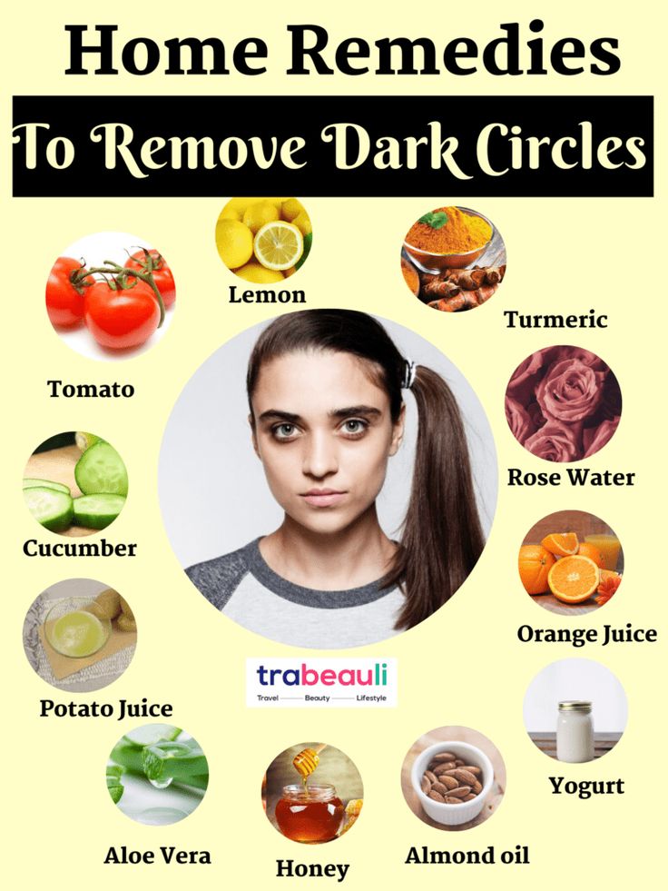 When Dark Circle Treatments Outperform Home Remedies