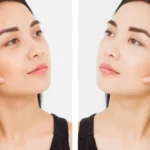 How Dark Circle Treatments Support Daily Routines